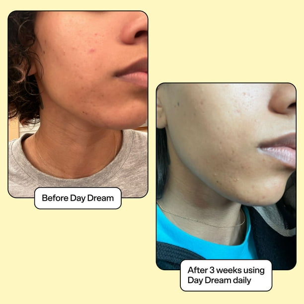 Bubble - Day Dream Vitamin C + Niacinamide Tone & Texture Serum - 30ml