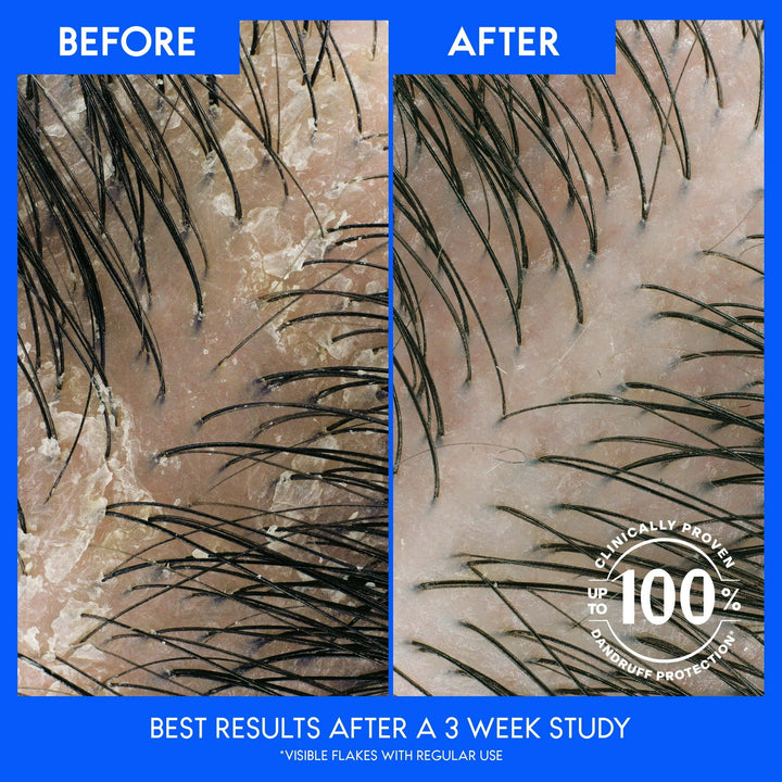 Head and Shoulders 2 in 1 Dandruff Shampoo and Conditioner Coconut