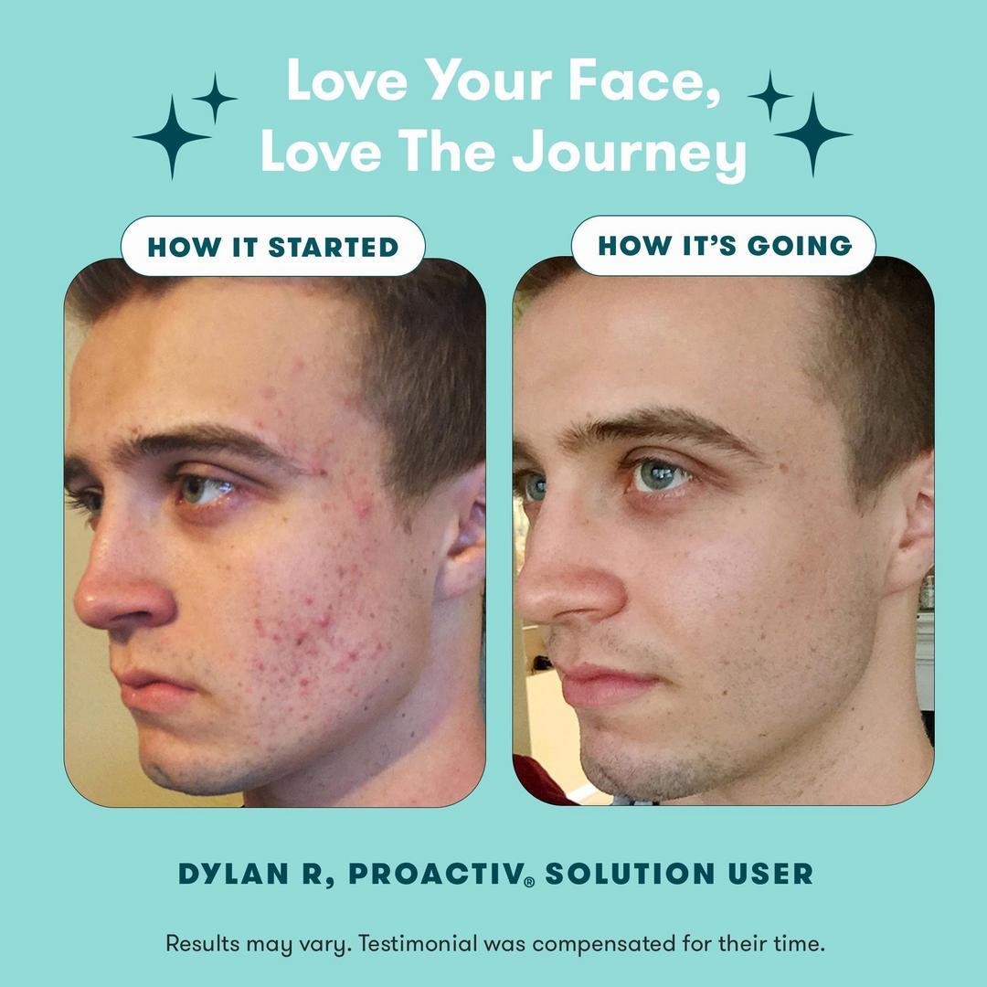 Proactiv Solution 3-Step Acne Treatment 60-Day Kit
