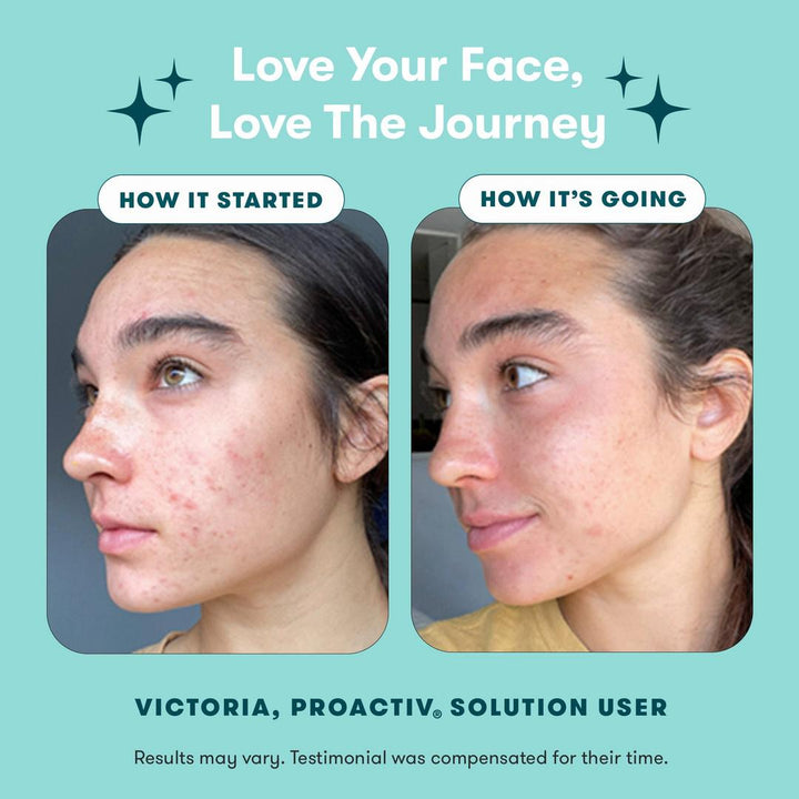 Proactiv Solution 3-Step Routine 30-Day Kit