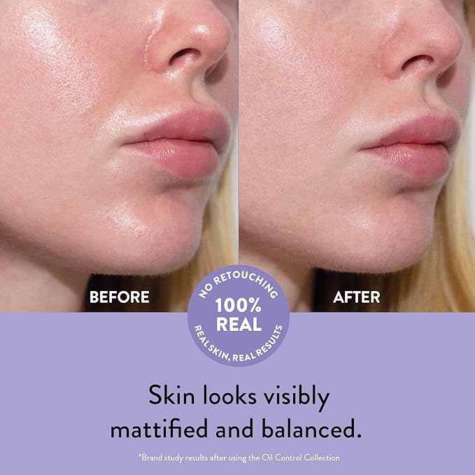Peach Slices - Olie Control Pore Serum - 30ml