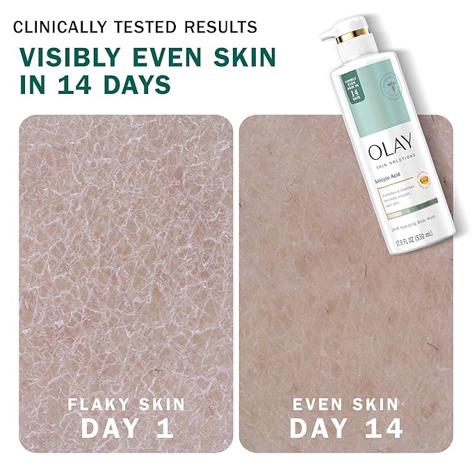 Olay - Skin Solutions Hydrating Body Wash with Salicylic Acid - 530ml