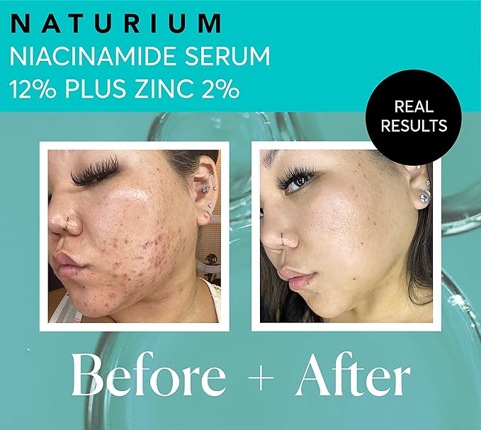 Naturium - Niacinamide Face Serum - Anti-Aging -  Dark Spot Corrector - Hyaluronic Acid & Vitamin E - 30ml