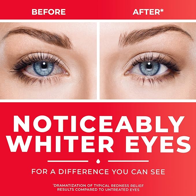 Clear Eyes - Redness Relief XL