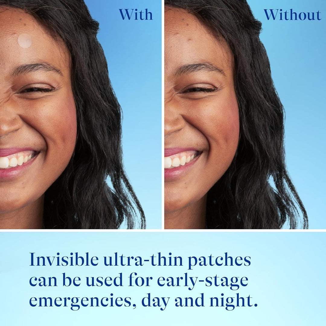 Differin Acne Prone Skin Patches