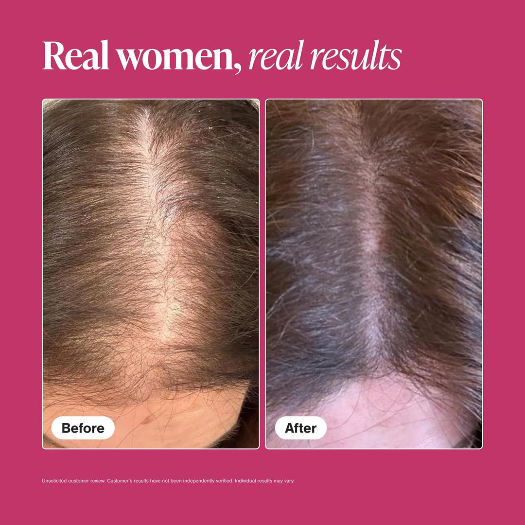 Viviscal Hair Growth Supplements for Women with Biotin & Marine Collagen 90-Day Supply