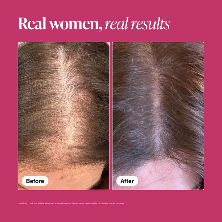 Viviscal Hair Growth Supplements for Women with Biotin & Marine Collagen 90-Day Supply