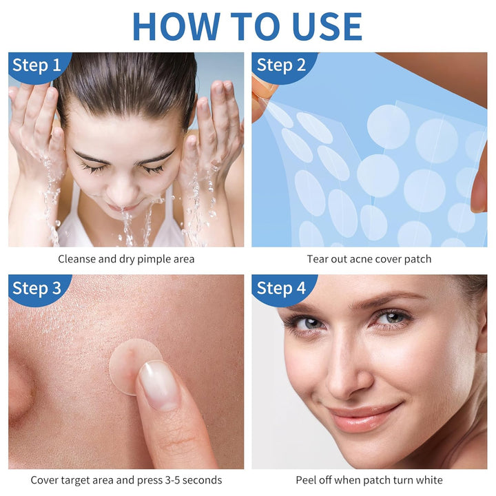Daolyo - Pimple Patches for Face  300 Counts