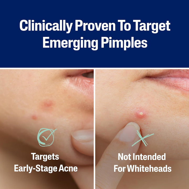 Cetaphil - Acne Patches, Pimple Patches - 24 patches
