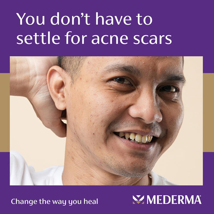 Mederma Acne Scar Serum with Niacinamide & Tetrapeptide-30