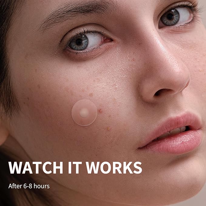 Daolyo - Pimple Patches for Face  300 Counts