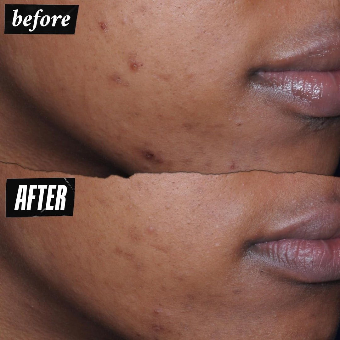 Kiehl's - Better Screen UV Serum SPF 50+ Collageenpeptide - Veroudering - Verbetert de huid - Uitstraling - 50 ml