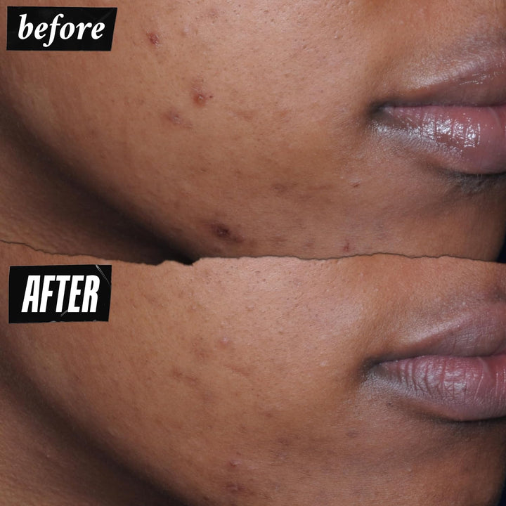 Kiehl's - Better Screen UV Serum SPF 50+ Collageenpeptide - Veroudering - Verbetert de huid - Uitstraling - 50 ml