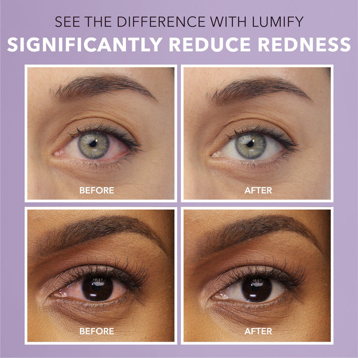 Lumify - Bausch + Lomb - Oogdruppels Tegen Hooikoorts - Rode Ogen - Geïrriteerde Ogen - 2.5ml