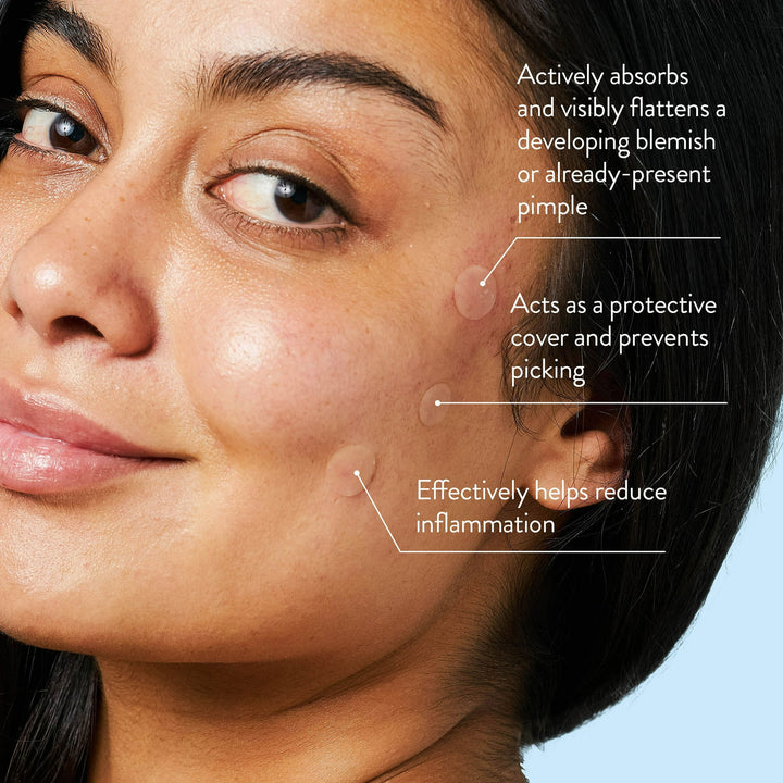 Perzikschijfjes - Acne-vlekjes - Hydrocolloïde puistjespleisters - 60 stuks